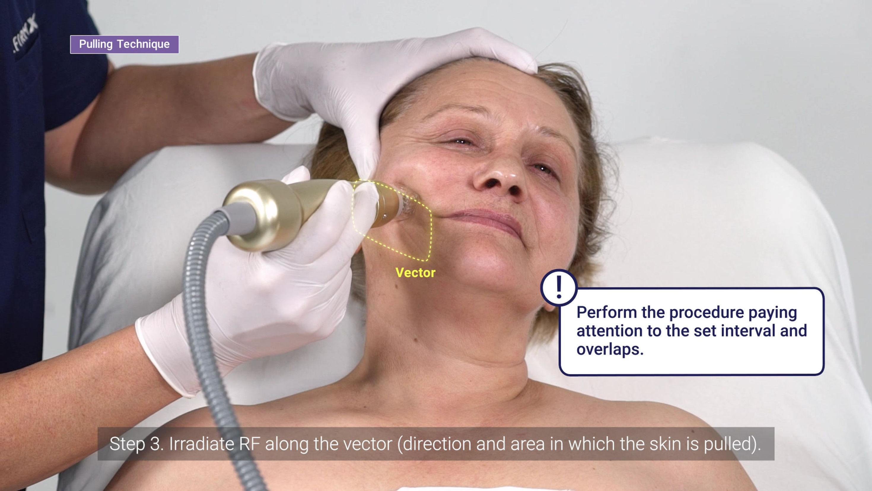 Behandlung mit Sylfirm X